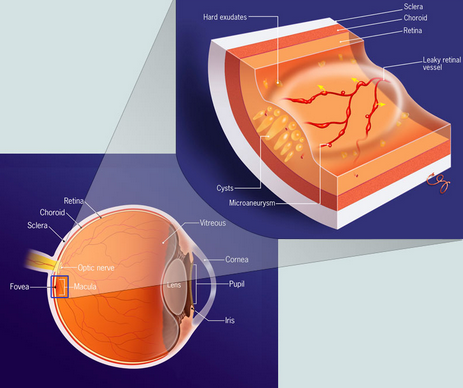 Ophthalmology